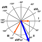 Exact Heart Axis Calculation